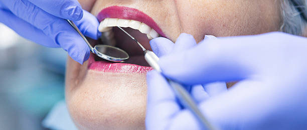 Best Chipped Tooth Repair Near Me  in Terre Du Lac, MO